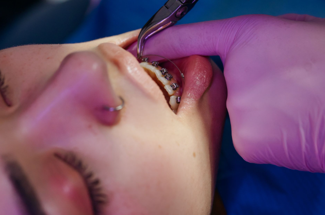 Grandir sur la Rive-Sud : pourquoi un suivi orthodontique fait toute la différence