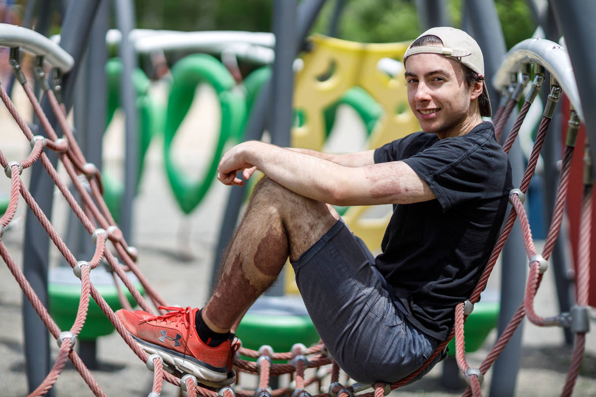 La remise en forme d&rsquo;un miraculé
