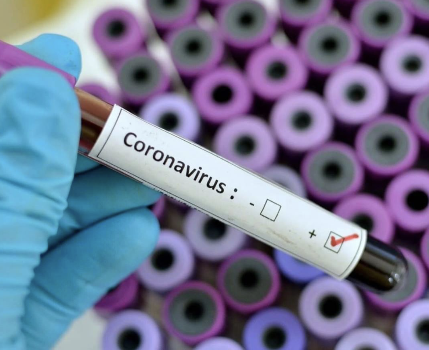 COVID-19: un total de 4672 cas dans l&rsquo;agglomération de Longueuil